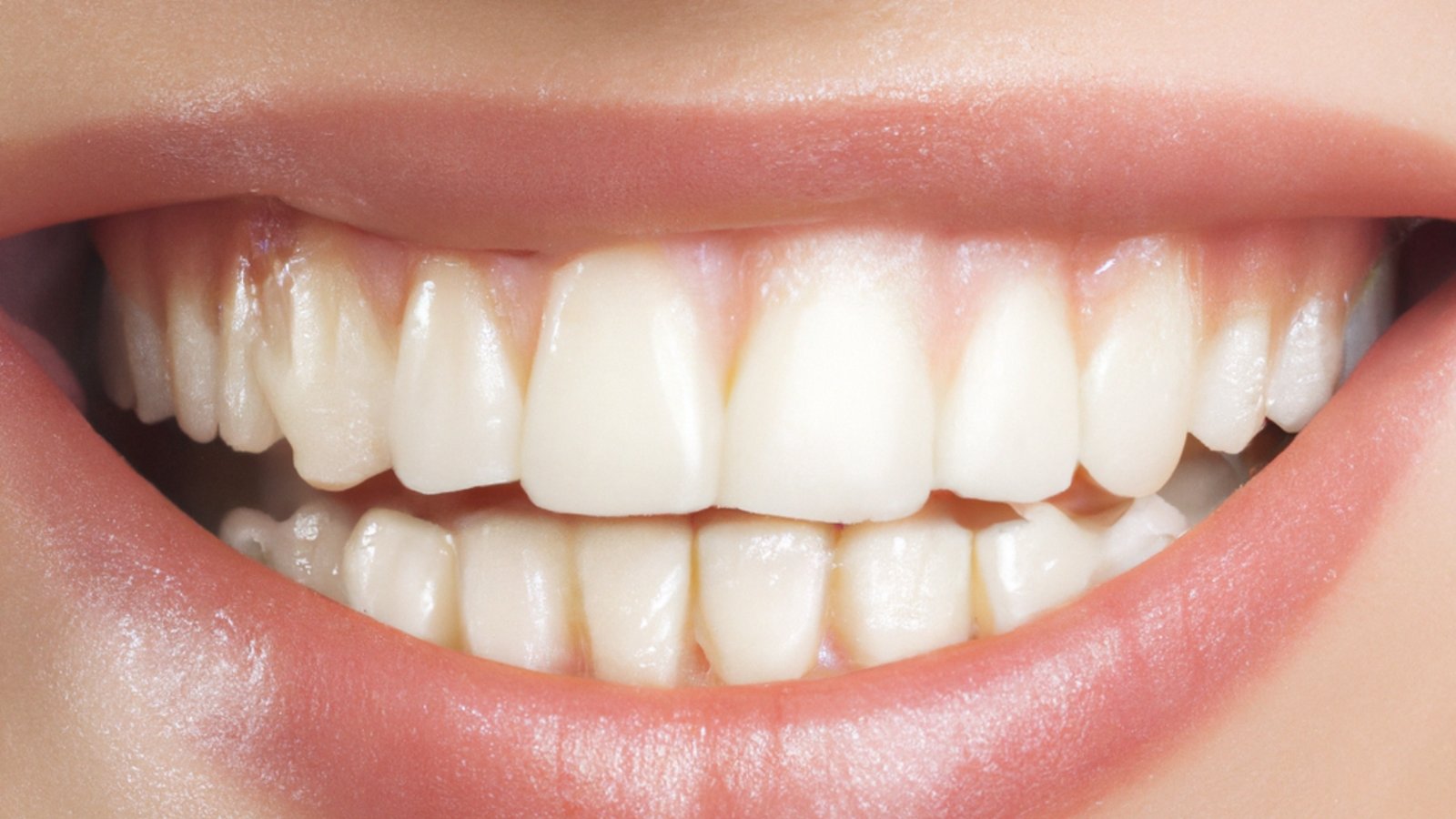 A detailed close-up of a perfect set of white teeth and lips in a bright smile.